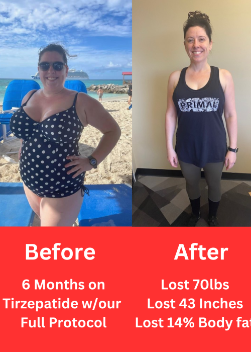 Before and after 2