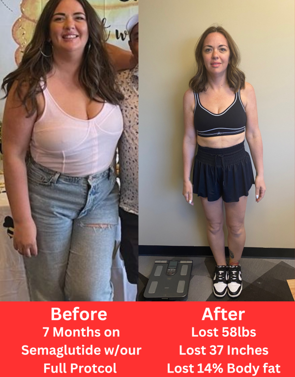 Semaglutide Weight Loss